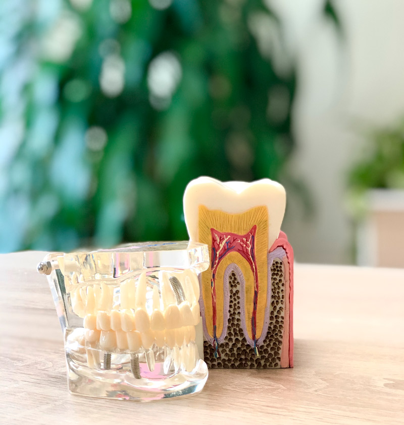 Imagen del Gabinete de la Clínica Dental Marroen la que se observa decoración dental.